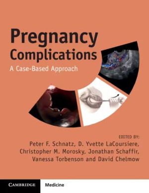 Book cover: Pregnancy complications : a case-based approach